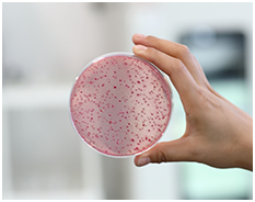 生物的危害要因：食中毒菌による汚染など